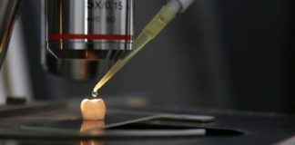 충치 치료 치아 에나멜 재생 혁신 기술 개발