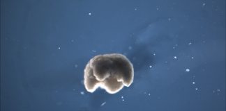 세계 첫 개구리 줄기세포로 살아있는 로봇 개발